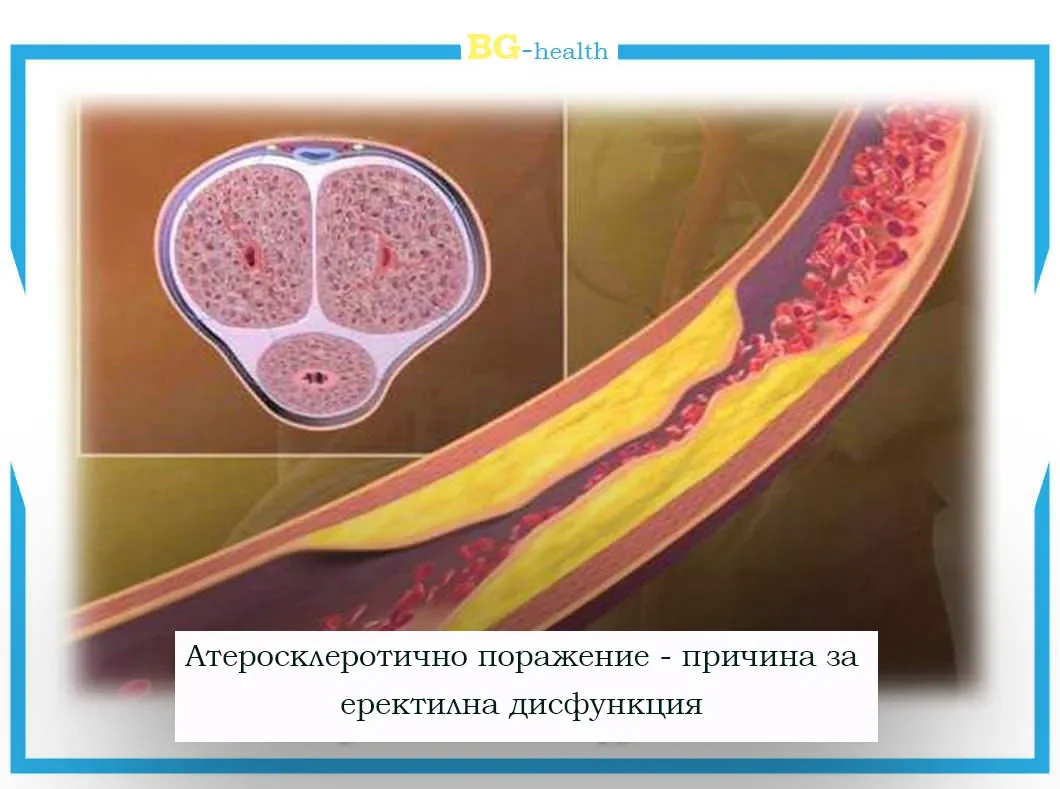 Balen ginseng : كيفية الاستعمال